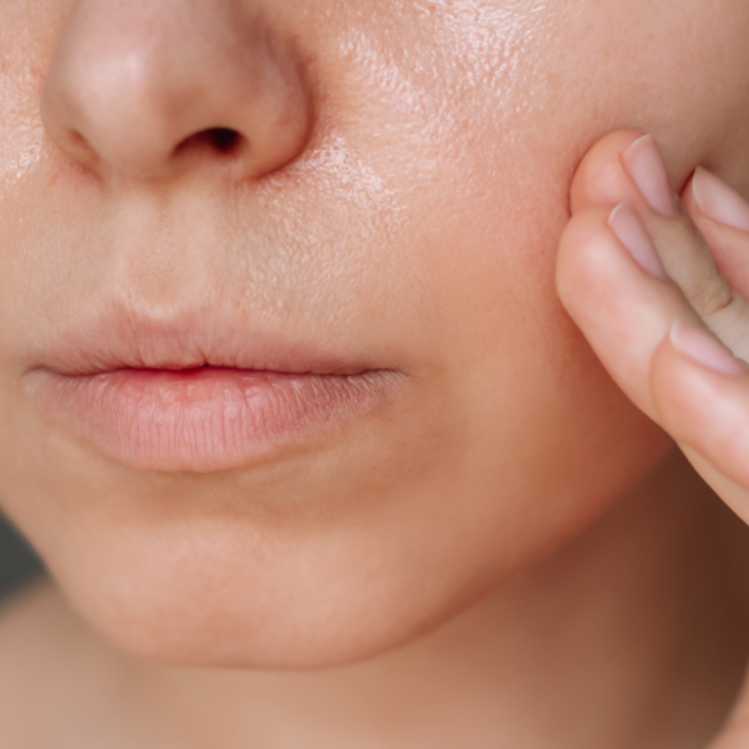 Close-up of a woman gently touching her cheek, showing concern for facial hair or skin changes linked to PCOS